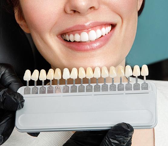 smiling woman with teeth color matcher