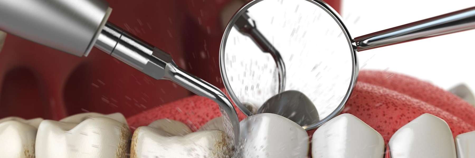 close up of teeth being cleaned at Humble Dentistry