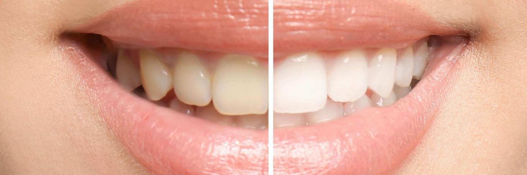 bright smile of a girl | preventive care in Humble TX