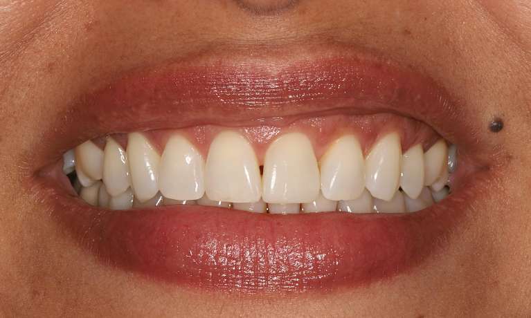 ABC-s-of-Cosmetic-Dentistry-After-Image