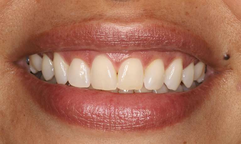 ABC-s-of-Cosmetic-Dentistry-Before-Image
