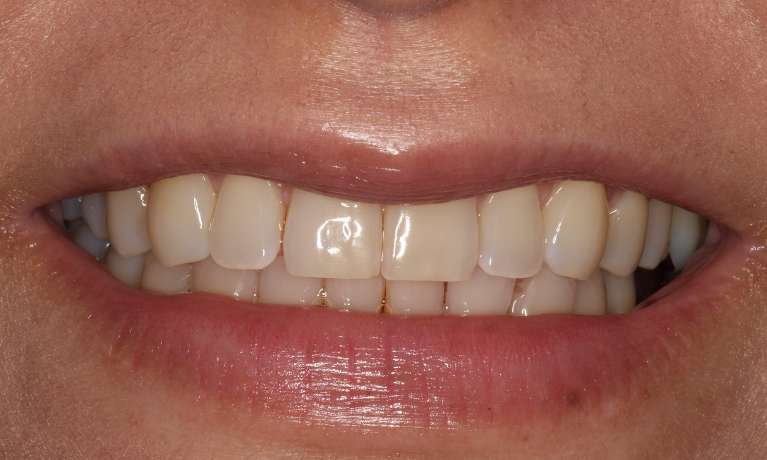 Comprehensive-Dentistry-in-One-Location-Before-Image